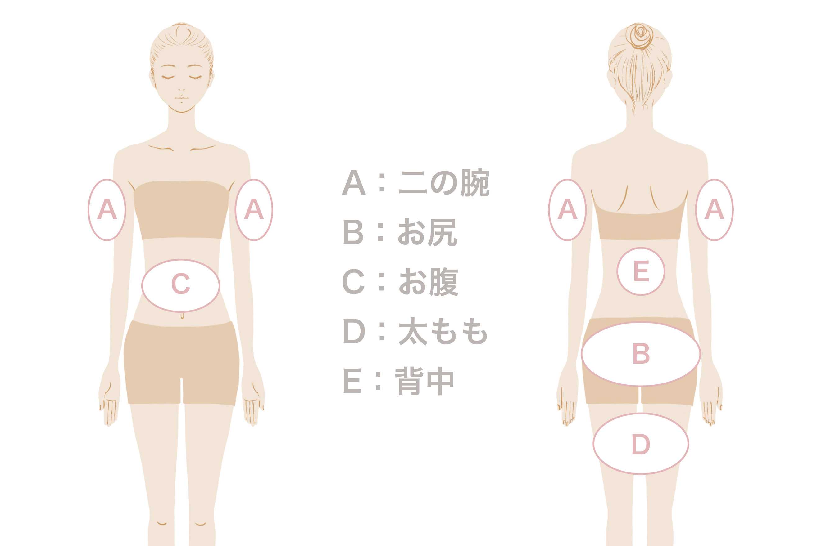 HIFU（ハイフ）ボディ施術箇所