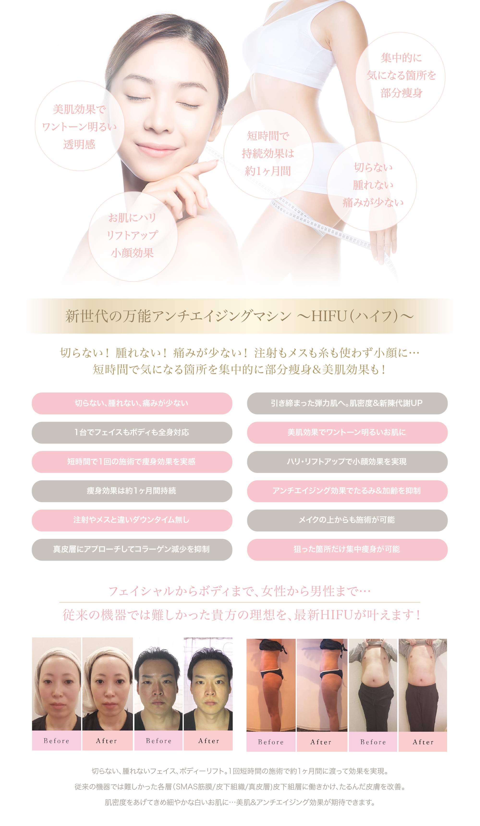 HIFU(ハイフ)説明